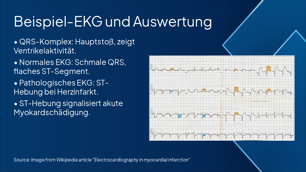 Slide 11 - Beispiel-EKG und Auswertung