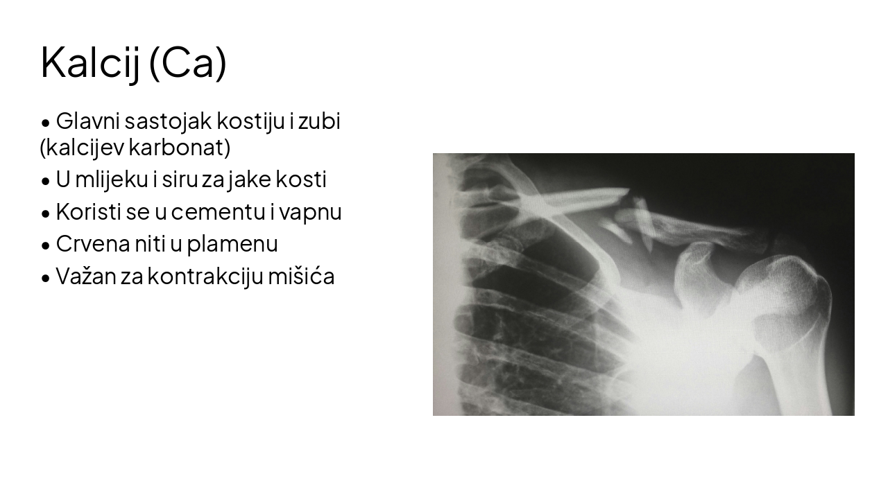 Slide 13 - Kalcij (Ca)