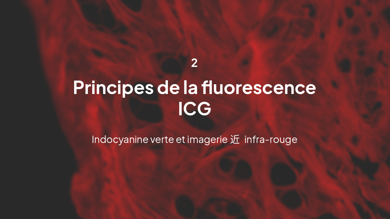 Slide 6 - Principes de la fluorescence ICG