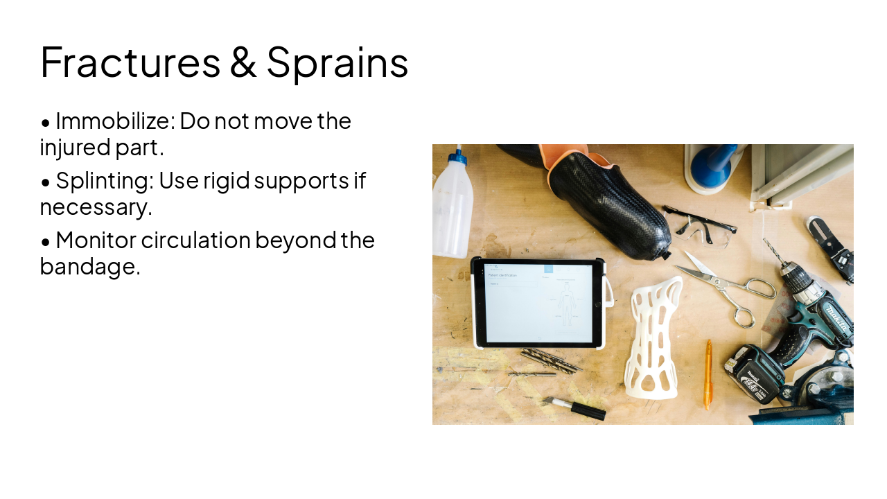 Slide 14 - Fractures & Sprains