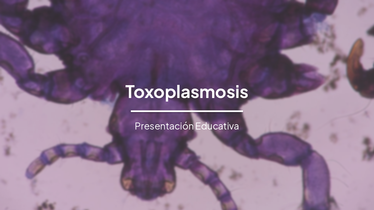 Slide 1 - Toxoplasmosis