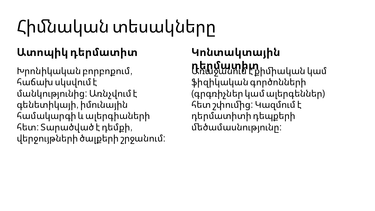 Slide 4 - Հիմնական տեսակները